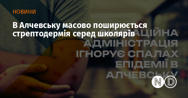 В Алчевську масово поширюється стрептодермія серед школярів
